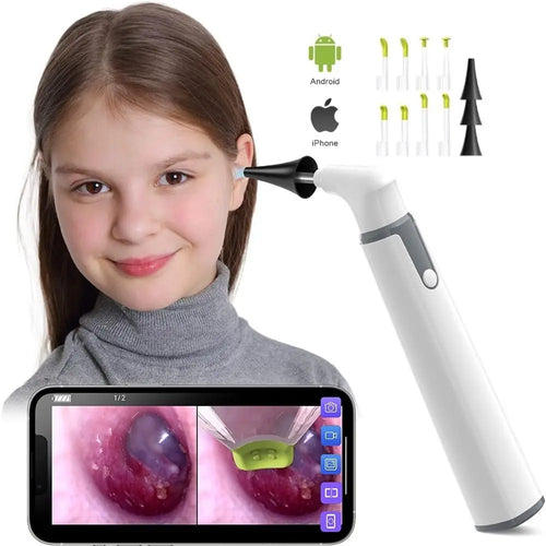 WIFI Digital Otoscope Ear Camera 3.9Mm Ear Cleaning Inspection Camera Ear Wax Removal Tools for Iphone Android